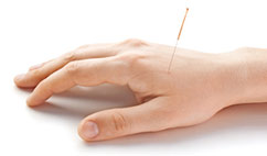 acupuncture